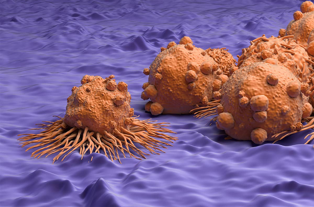 3D illustration of Carcinoma cells field in kidney cancer